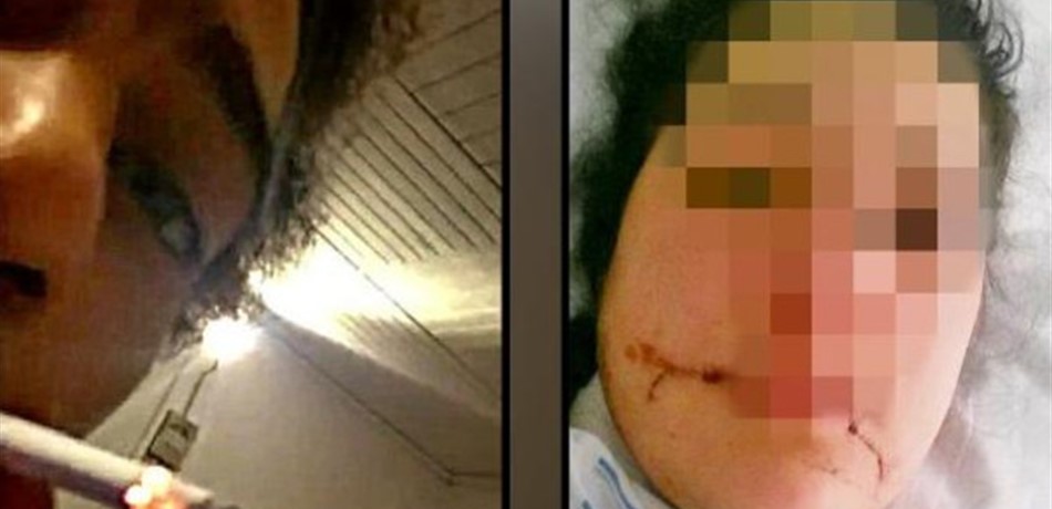 صورها وهي تنزف: فيديو مروّع لنارح قتل شقيقته الحامل.. هذا مصيره