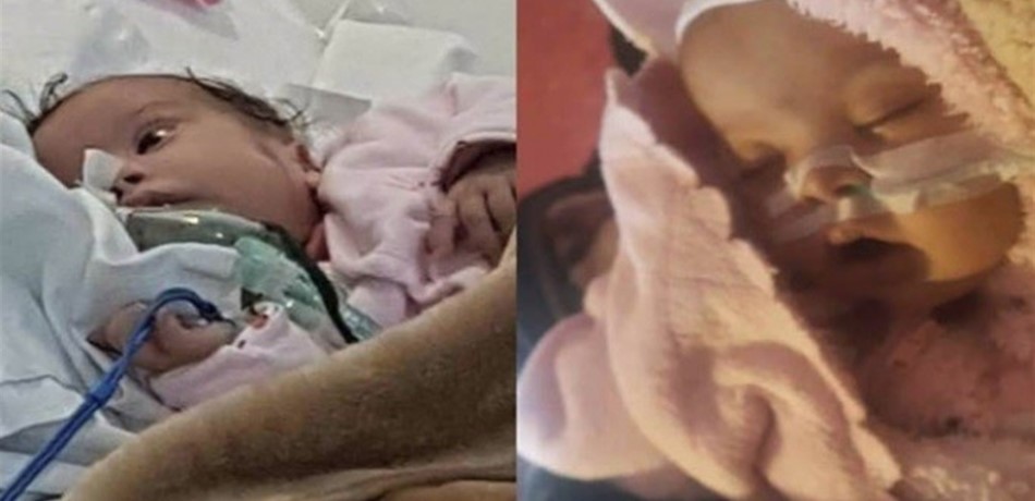"أماندا" أغمضت عينيها.. ابنة الـ5 أشهر ضحية جديدة للأخطاء الطبية<br/>