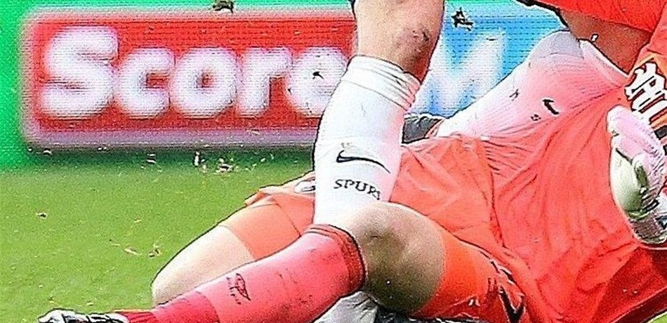 إصابة صادمة لـ"كين".. هل يغيب عن المونديال؟