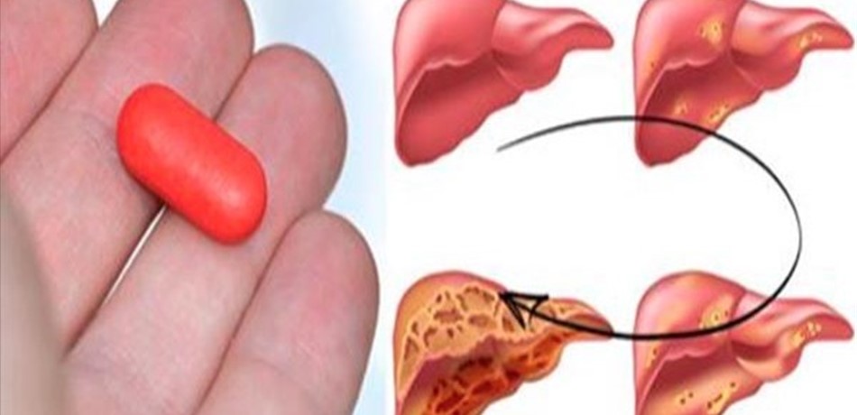 موجود في منازلكم.. كيف يدمر "الباراسيتامول" كبدكم خلال 3 سنوات؟