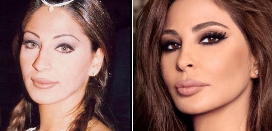 بالصور.. هكذا تبدو النجمات بعد عملية تجميل الأنف.. لكن كيف كنّ قبلها؟