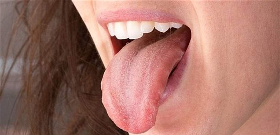 كيف تعرف حالتك الصحية من لسانك؟