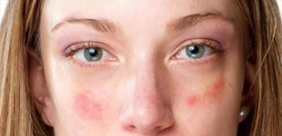 هكذا يمكن لصاحبات البشرة الحساسة اخيار مستحضرات التجميل