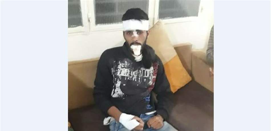 في وادي خالد.. المواطنون يسقطون داخل حفر تمديد الإنترنت! (صور) 