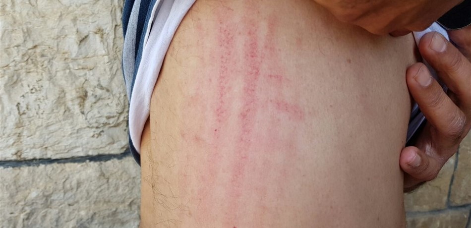 اعتداء بالضرب على أشخاص في بزبينا.. وهيئة "الوطني الحر" ترد