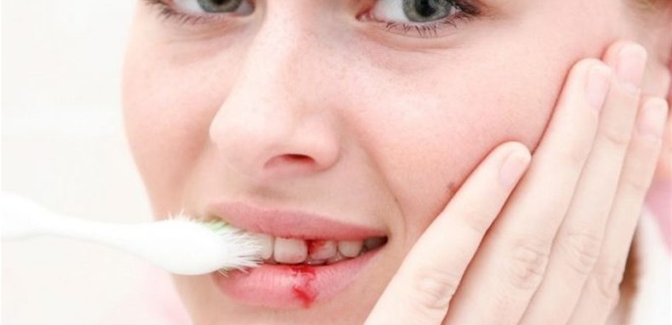 لا تستهينوا بنزيف اللثة.. قد يدل على مشاكل صحية خطيرة!