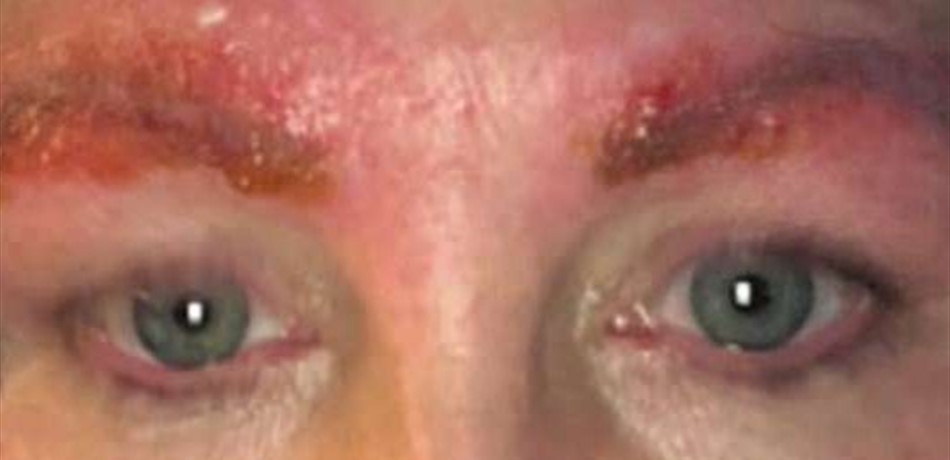 صور مخيفة.. أجرت عملية تجميل رخيصة فكلّفتها ثمنًا فادحًا!