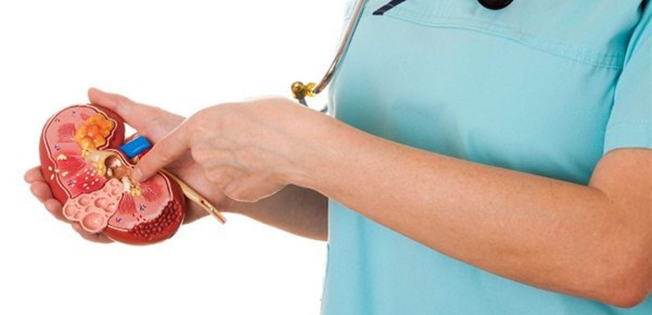 أطعمة تطرد الحصيات الكلوية.. ما هي؟