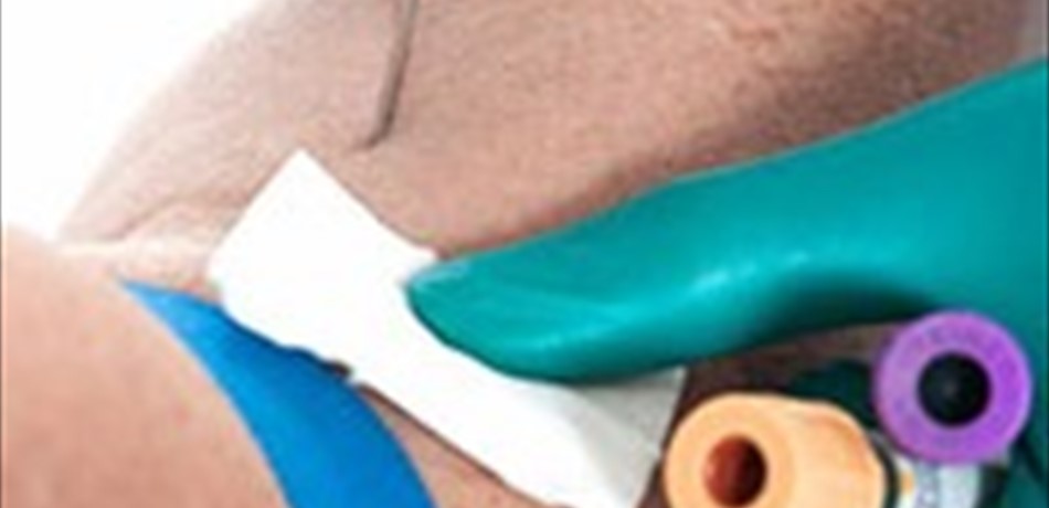 اختبار جديد للدم يكشف عن تلف الكبد في أقل من ساعة