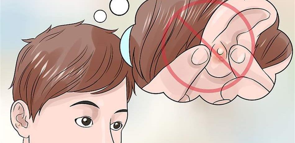 لا تستهينوا بـ"بثور الأذن".. هذه أسبابها وكيفية علاجها 