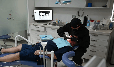 لماذا تفشل بعض زراعات الأسنان رغم المضادات الحيوية؟